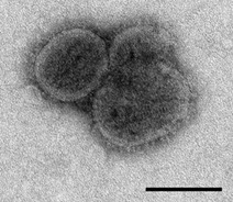 Bourbon virus sphere (EID 2015 Fig 2b)