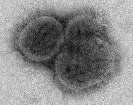 Bourbon virus sphere crop (EID 2015 Fig 2b)