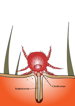 Chigger bite 700px