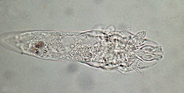 Demodex mite