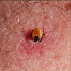 embeddedtick
