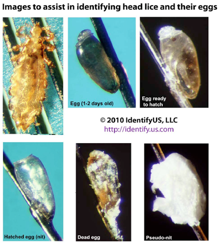 IdentifyHeadLice