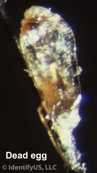 Head louse - dead egg