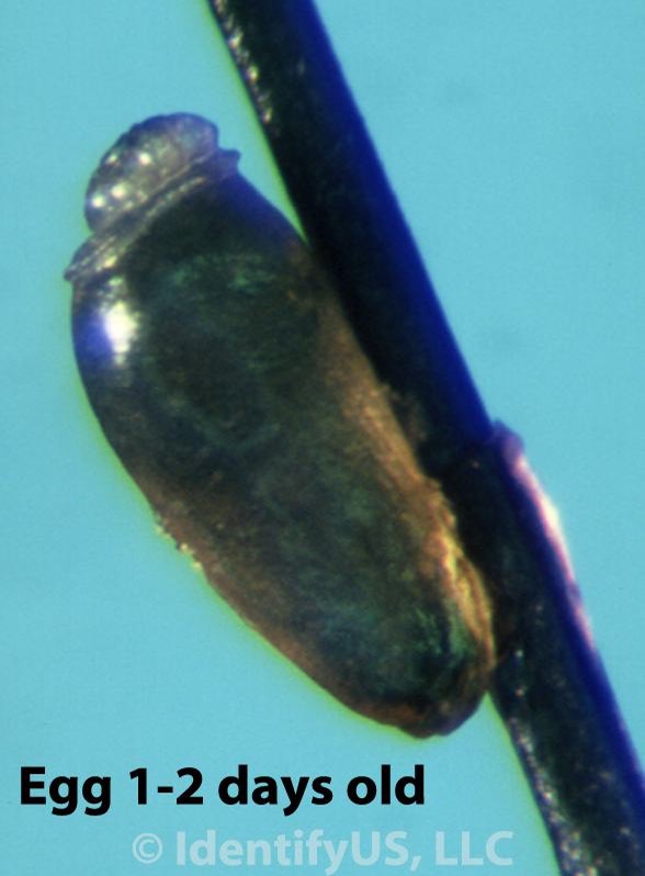 head louse egg