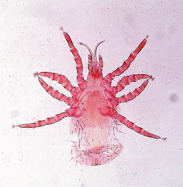 Ornithonyssus mite