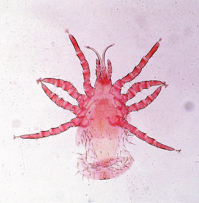 Ornithonyssus mite