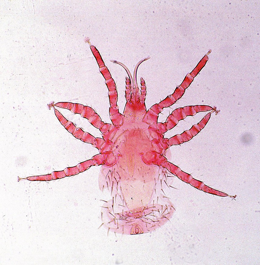 Ornithonyssus-mite