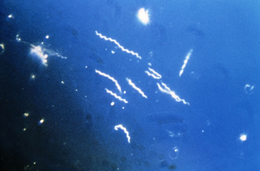PHIL 6631 Borrelia burgdorferi