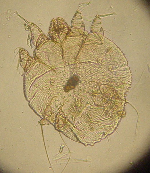 Sarcoptes scabiei mite