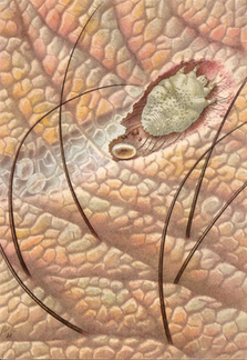 Sarcoptes scabiei