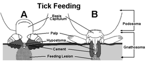 Tickattack