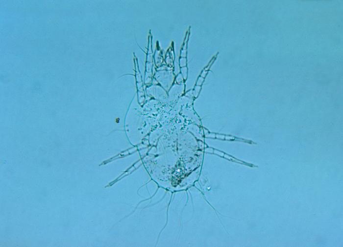 Trombicula